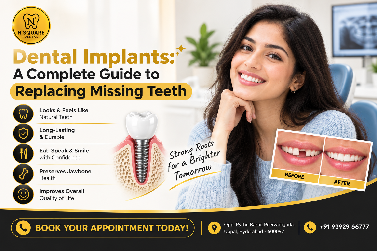Dental Implants: A Complete Guide to Replacing Missing Teeth