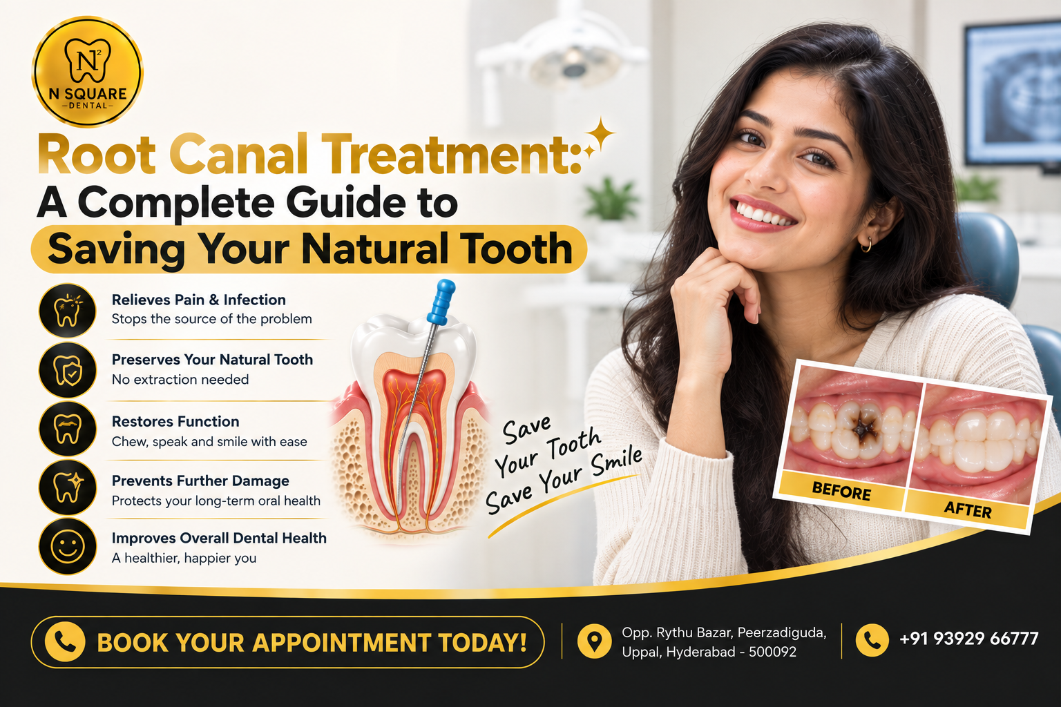 Root Canal Treatment in uppal