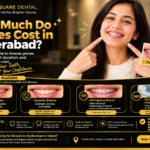 Braces cost in Hyderabad