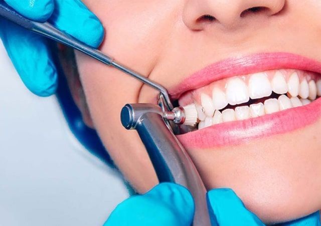 Teeth Whitening: A Complete Guide to a Brighter